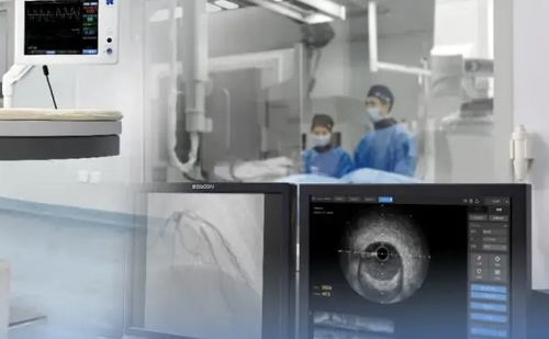 上半年45個創(chuàng)新醫(yī)療器械獲批，國產(chǎn)超聲設備向高端化邁進